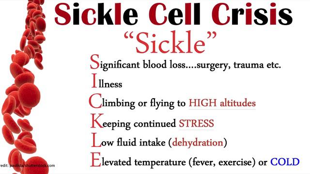 Sickle Cell Anemia Nursing | Symptoms, Pathophysiology, Sickle Cell Crisis & Trait смотреть онлайн