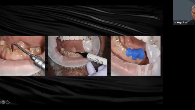 Dental Treatment: Smile Design Apr 6, 2021 смотреть онлайн