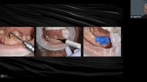 Dental Treatment: Smile Design Apr 6, 2021