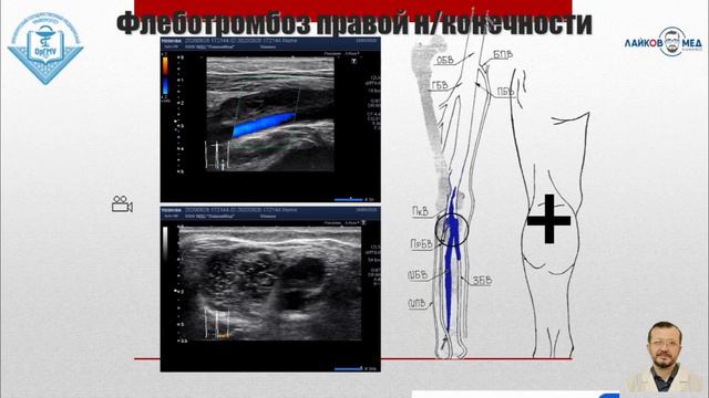 Клинические случаи