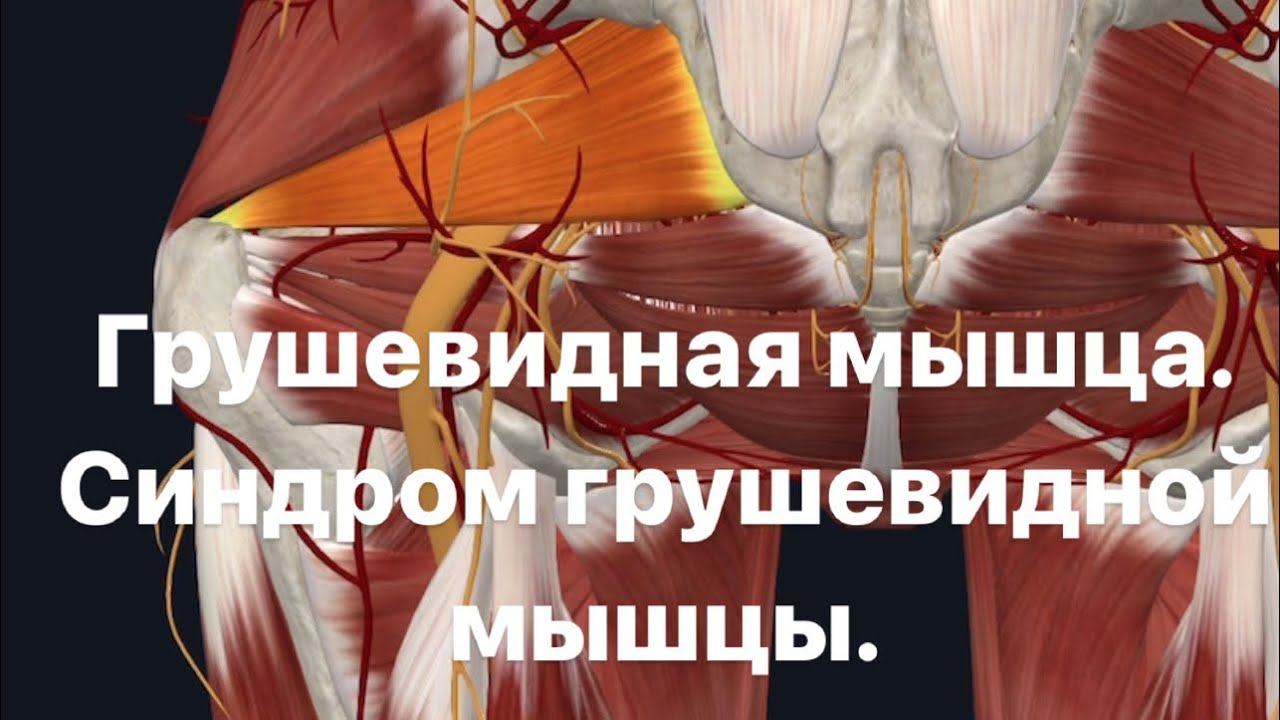 Грушевидная мышца. Синдром грушевидной мышцы. Воспаление седалищного нерва. Как расслабить?