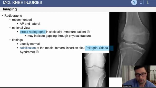 MCL Knee Injuries Exam Review - Raymond Kim, MD смотреть онлайн