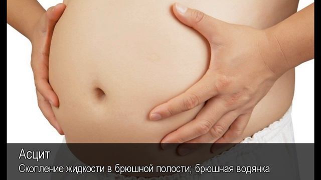 Асцит. Толковый Видеословарь русского языка смотреть онлайн