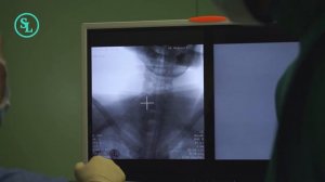 ГРЫЖА ДИСКА - ОПЕРАЦИЯ на шейный отдел и установка кейджа HRC