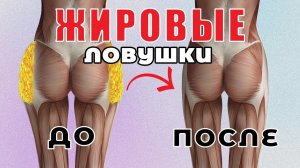 УБИРАЕМ УШКИ НА БЕДРАХ. Эффективные упражнения от ГАЛИФЕ и ПОПИНЫХ УШЕЙ