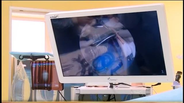 Операция по восстановлению связок суставов на уникальном оборудовании в клинике "УГМК - Здоровье" смотреть онлайн