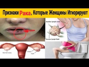5 Важных Признаков РАКА, Которые Не Следует Игнорировать Женщинам.