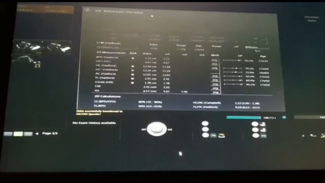 Узи на 16 неделе. Узнали пол ребёнка мальчик смотреть онлайн