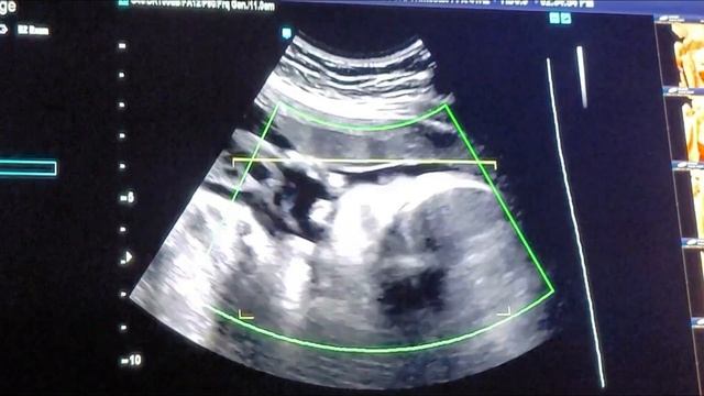3D Ultrasounds |My 29 Weeks | Following My Pregnancy | Pregnant Over Age 35