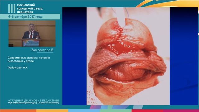 Симпозиум "Актуальные вопросы репродуктивного здоровья мальчиков" смотреть онлайн