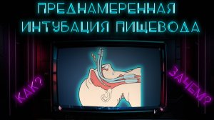 Интубация пищевода вместо трахеи. Как и зачем? #ПроСМП