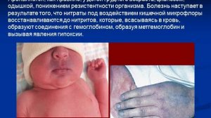 Лекция. Физиологическое, гигиеническое, эпидемиологическое значение воды.