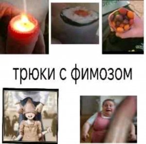 фимоз 4 степени