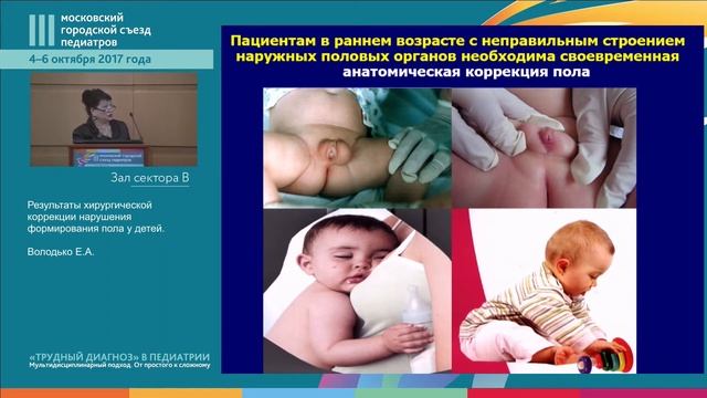 Симпозиум "Современные аспекты ведения детей с нарушениями полового развития" смотреть онлайн