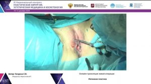 Трансляция живой операции: Интимная пластика