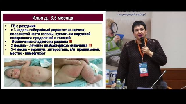 Типичные ошибки при ведении детей с пищевой аллергией смотреть онлайн