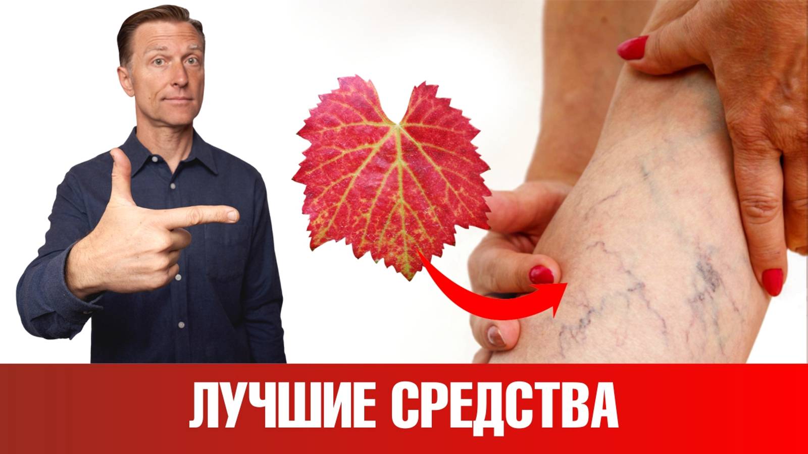 Варикоз на ногах и сосудистые звездочки? Средство от варикоза №1👍 смотреть онлайн