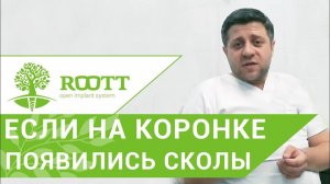 Металлокерамические коронки. 👑 Что делать, если на металлокерамической коронке появились сколы