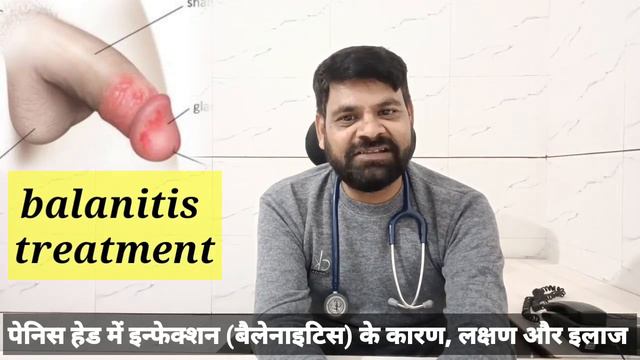 balanitis treatment in hindi ! पेनिस हेड में इन्फेक्शन (बैलेनाइटिस) के कारण, लक्षण और इलाज смотреть онлайн