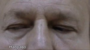 Энцефалопатия Вернике-Корсакова