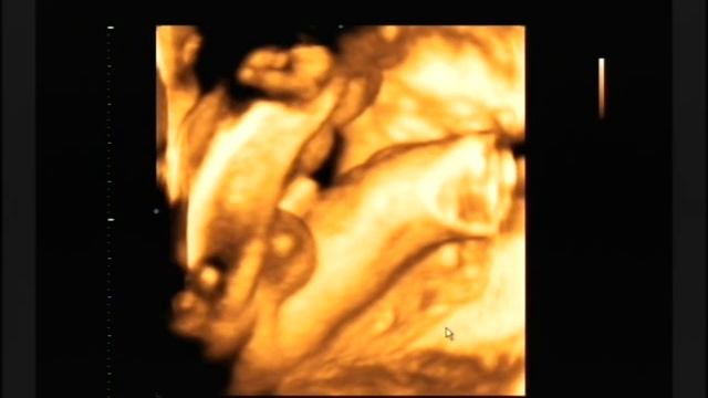 3D УЗИ, мой мальчик 28 недель. смотреть онлайн
