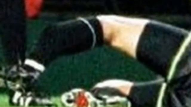 Worst_Sport_Injuries_lose his leg.flv смотреть онлайн