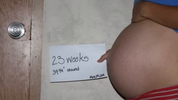 Triplet Pregnancy Belly