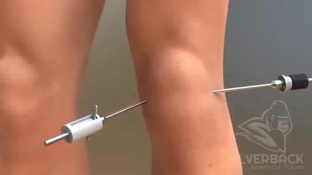 Что делать при боли в коленях? смотреть онлайн