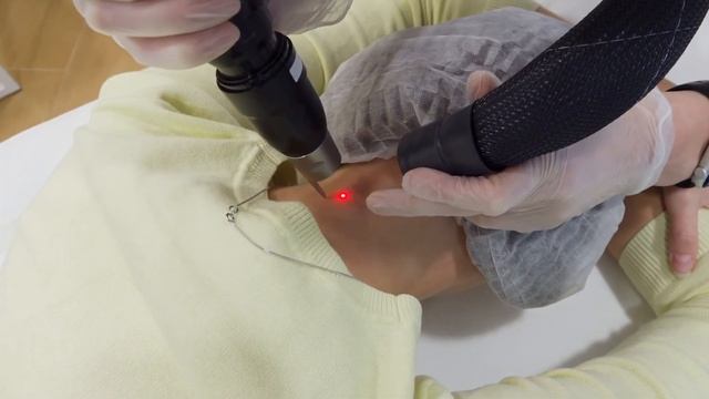 Удаление татуировки лазером Picosure в клинике DELETE. Видеоотзыв смотреть онлайн