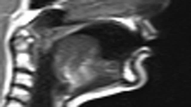 Ultrax MRI Cardinal 7 смотреть онлайн