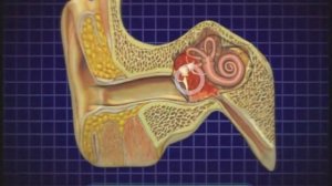 Галилео. Слух (часть 2). Потеря слуха