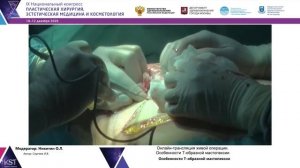 Трансляция живой операции: Особенности Т-образной мастопексии