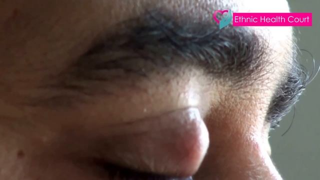 Get rid of eye stye | കൺകുരു മാറ്റാൻ എളുപ്പ വഴി | Ethnic Health Court смотреть онлайн