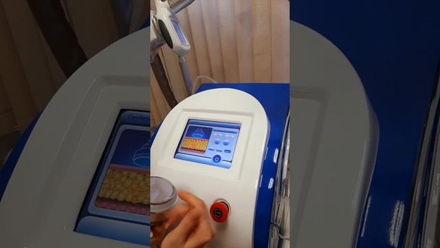 Обзор Крио + РФ + Кавитация смотреть онлайн