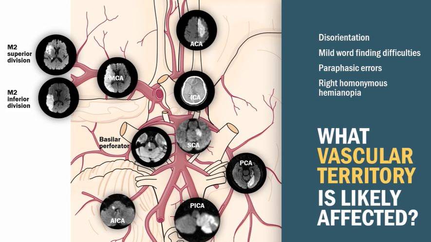 Анатомия сосудов головного мозга смотреть онлайн