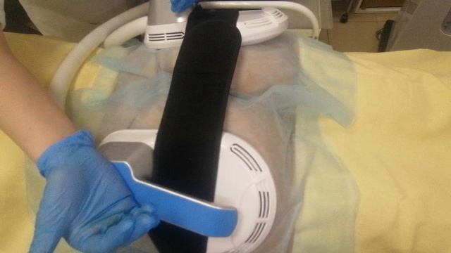 Аппарат Электромагнитная стимуляция HIEMT. Качаем попу. Медклуб. Оборудование. смотреть онлайн