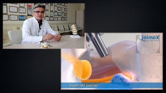 Малоинвазивная операция при грыже диска | Эндоскопическое удаление смотреть онлайн