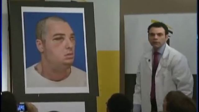 Complete Face Transplant - CTV Lethbridge - Mar.28/12 смотреть онлайн