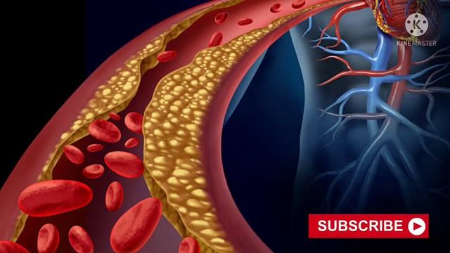 High Cholesterol Symptoms | Normal Range Of Cholesterol | Cholesterol Malayalam смотреть онлайн