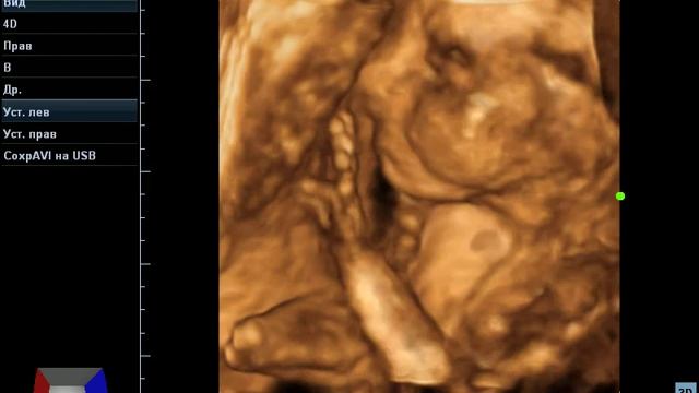 Моя девочка 26 недель смотреть онлайн