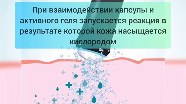 Процедура на аппарате Карбокситерапии Оксигенео смотреть онлайн
