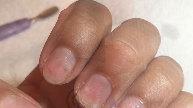 Epix from Orly смотреть онлайн