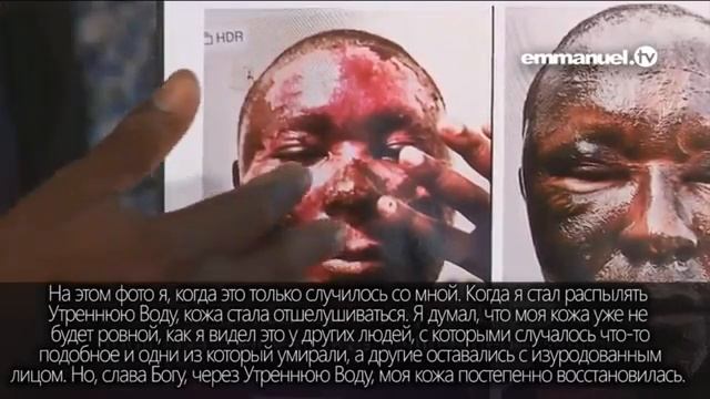 Смотрите, что произошло с лицом этого человека смотреть онлайн