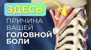 Головная боль. Головокружение. Боль в шее. Одна причина, убрав которую, вы не вспомните про таблетки