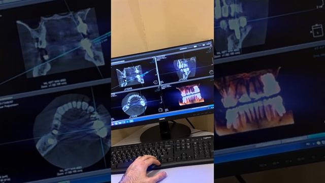 Актуальные акции стоматологии Илатан! смотреть онлайн