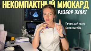 Некомпактный миокард. Разбор эхокардиографии.