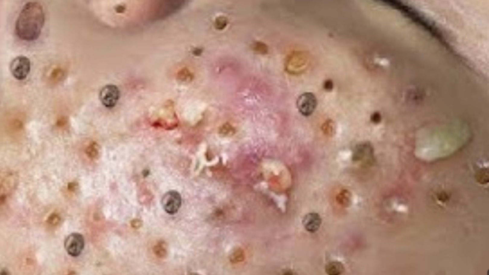 ПРЫЩИ, УГРИ. ЧИСТКА КОЖИ. ПОДПИШИСЬ! ТЕБЕ ЭТО ВЫГОДНО!