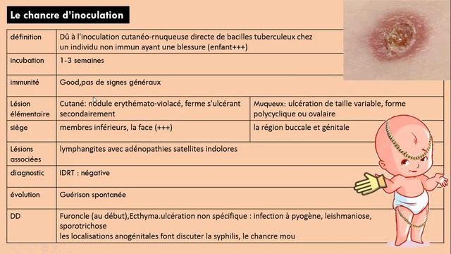 Tuberculose cutanée partie 1 ( cours + qcm ) , cours de dermatologie смотреть онлайн