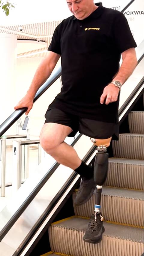 На протезе бедра ходьба по лестнице попеременным шагом смотреть онлайн