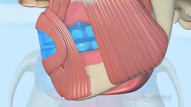 How Does Myobrace Work? смотреть онлайн